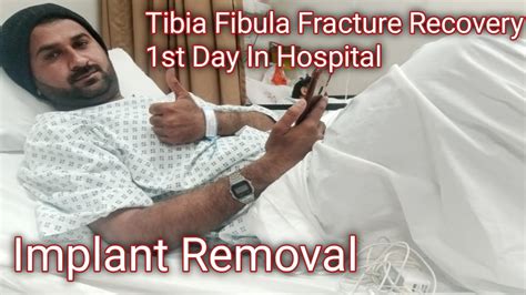 Tibia Fibula Fracture Recover Finally Implant Removal Hugya The