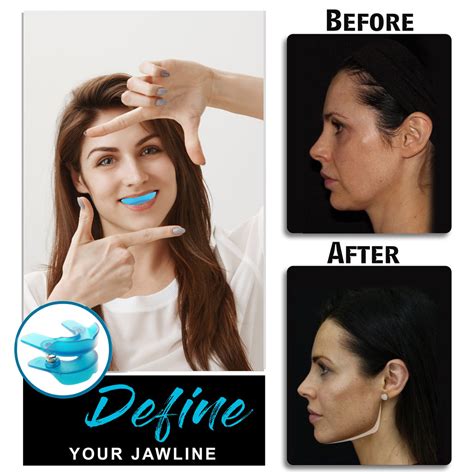 Jaw Exercise Tool Jawflex®