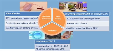 Eau 2020 How To Manage Testicular Microlithiasis And Carcinoma In Situ