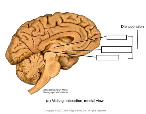 Diencephalon Diagram | Quizlet