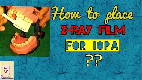 Dental X Ray Film Placement Position Of X Ray Film To Take Intra Oral Periapical Radiograph