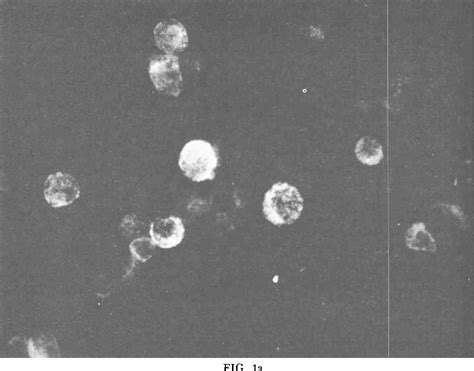 Figure 1 From Cloning Of Immunoglobulin Producing Human Leukemic And