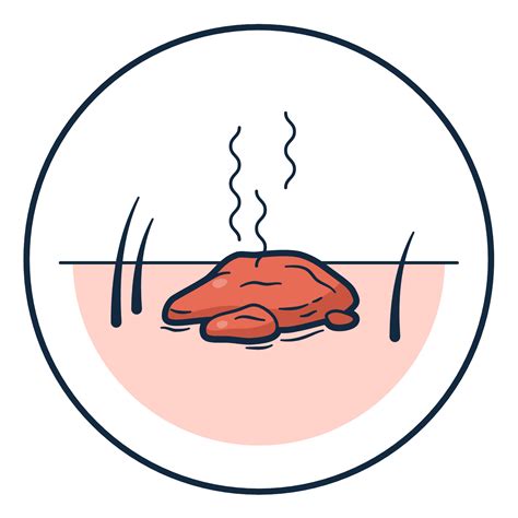 Can Human Get Fleas From Dogs at Stephanie Daley blog
