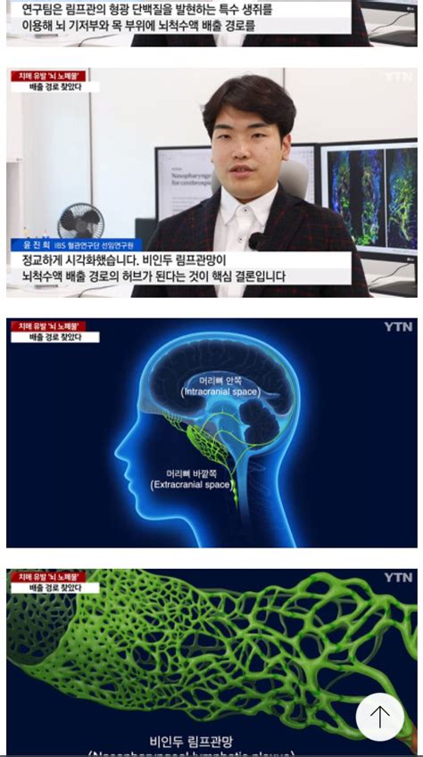 치매 연구 근황 뇌 노폐물 배출경로 찾음 오리광장 뉴덕