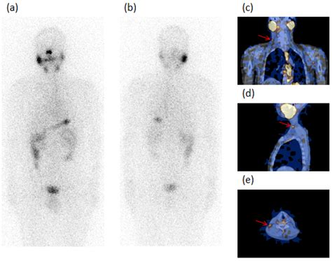 Diagnostics Free Full Text A Comparative Follow Up Study Of