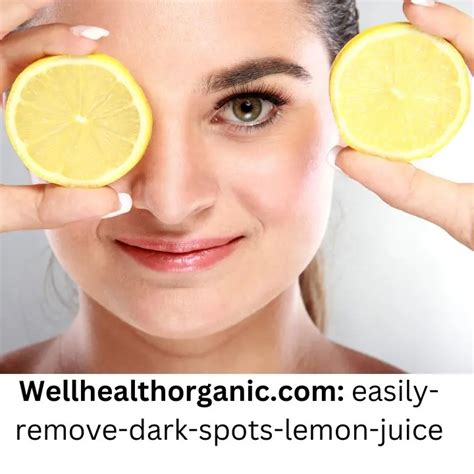 Lemon Juice For Glowing Skin And Dark Spots Removal