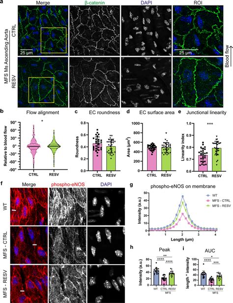 Normalization Of Ec Morphology After Resveratrol Treatment In The