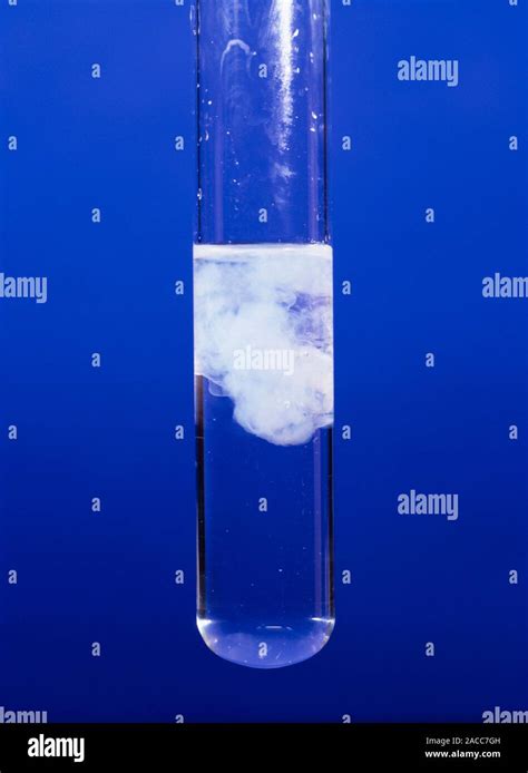 Zinc Hydroxide Precipitate Formed By Adding Sodium Hydroxide Naoh To