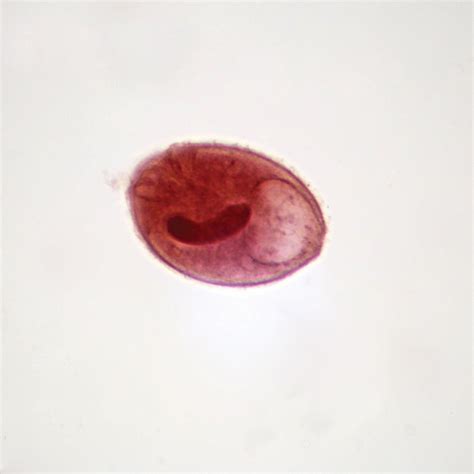 Balantidium Coli Trophozoites Smear Microscope Slide