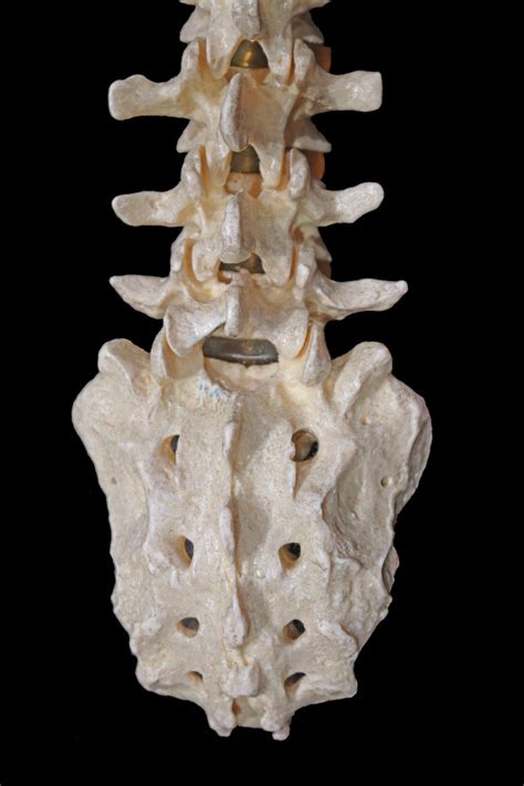 Lumbar Spine Model