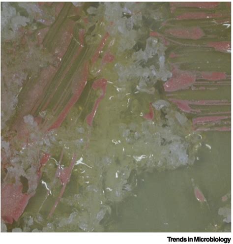 Halobacterium Salinarum Microscope