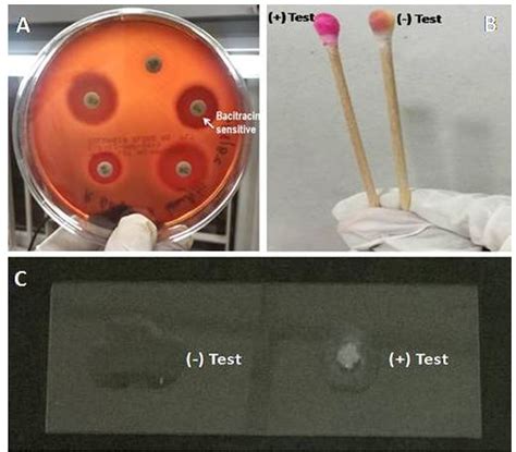 Bacitracin Test