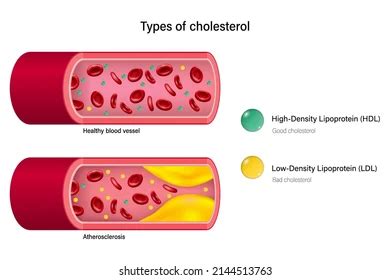 What are the benefits of HDL cholesterol in the body? - Living Good