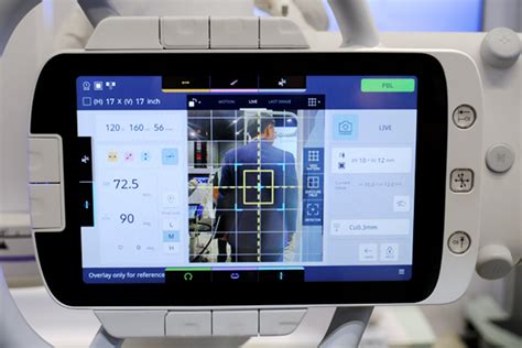 Rsna Radspeed Pro