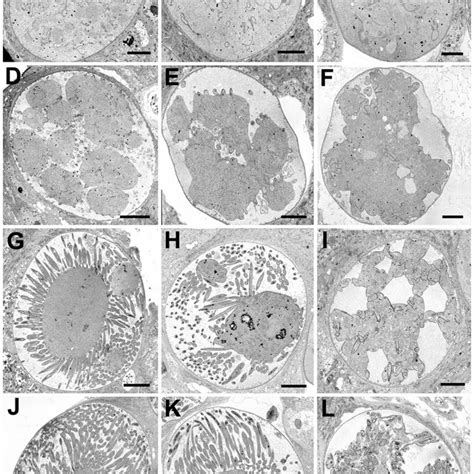 PDF The Repeat Region Of The Circumsporozoite Protein Is Critical For