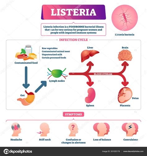 Image Vectorielle Illustration Vectorielle De Listeria Programme