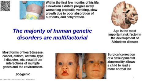 Ftm Lecture Multifactorial Inheritance Flashcards Quizlet