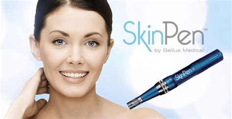 Skin Pen San Jose Skin Care And Rejuvenation Clinic