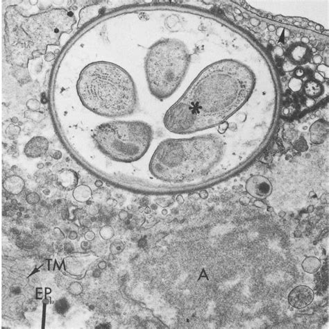 Schematic View Of A Cyst Form Where The Main Structures Are Indicated Download Scientific Diagram