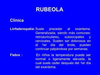 Rubeola(1) | PPT