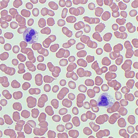 Neutrophil Morphology Blood Film Medschool