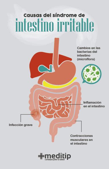 Síndrome De Intestino Irritable Causas Diagnóstico Y Tratamiento