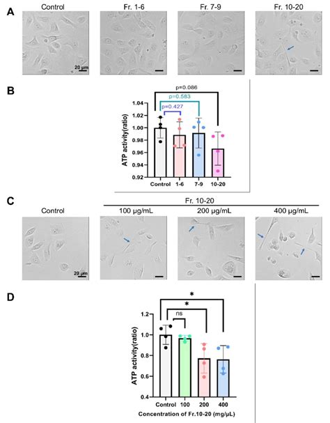 Cytotoxicity Of Macrophage Derived Small Exosomes To Oral Cancer Cells