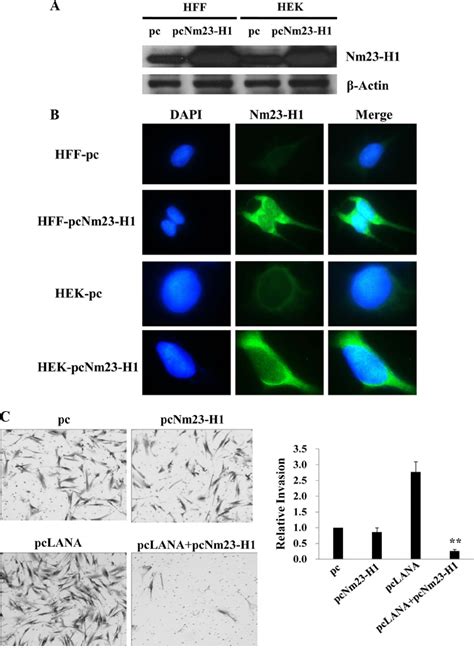 Cytoplasmic Overexpression Of Nm23 H1 Inhibits Cell Invasiveness