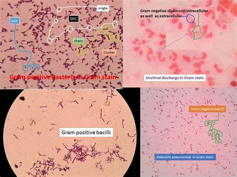 Hucker modification Gram stain: Composition, preparation and procedure