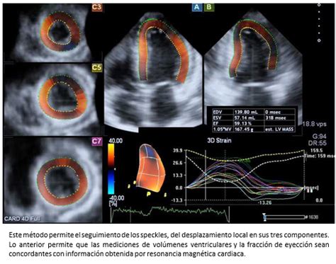 Ecocardiografía Y Doppler Cardíaco