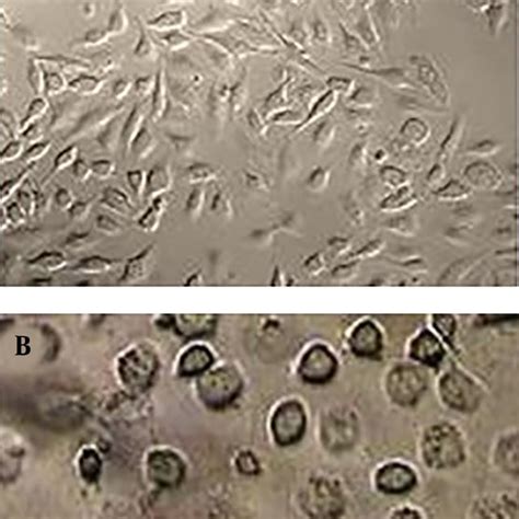 Light Microscopy Of Hela Cells Cultured With Or Without The 100 µgml