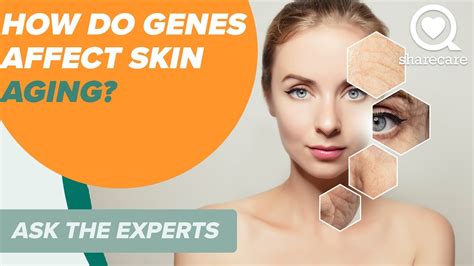 How Do Genes Affect Skin Aging Ask The Experts Skin Sharecare