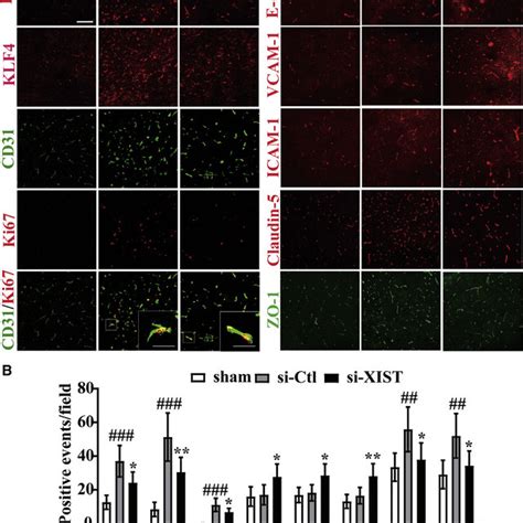 Silencing Of Lncrna Xist Aggravates Cerebral Ischemia Induced Brain