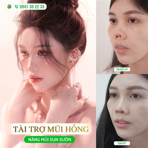 Hot Tiktoker Huy N Em Nhan S C Ho N H O Sau N Ng M I