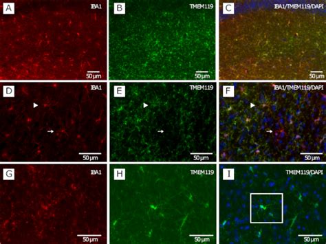 Immunofluorescence Staining Using Iba And Tmem For Microglial