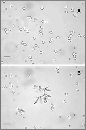 Cell Morphology Of Yeast Strains A Yeast Like Growth Of Turbo S