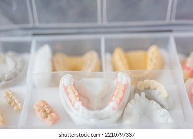 764 Porcelain Braces Images, Stock Photos & Vectors | Shutterstock