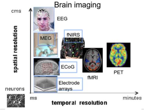 Kernel Brain Computer Interface and General BCI Technology Overview ...