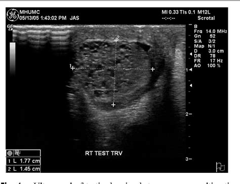 Rete Testis Ultrasound