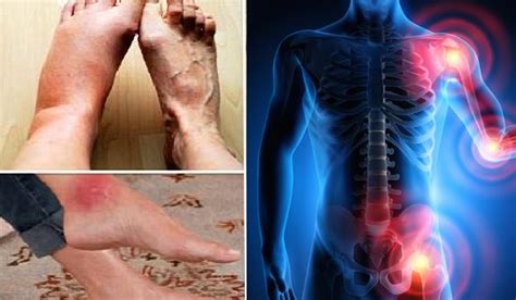 These Two Types Of Inflammation Cause Cancer Here Is How You Get Rid Of It