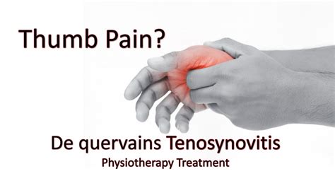 De Quervains Tenosynovitis Or Thumb Pain Or Gamers Thumb Treatment And