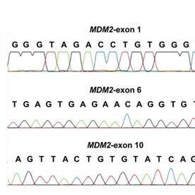 The Schematic Shows The EVs Being Released From Cells Relevant To DDLPS