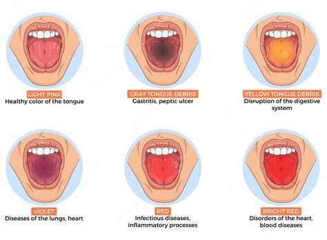 Premium Vector | Llustration of diagnosis of different diseases by the ...