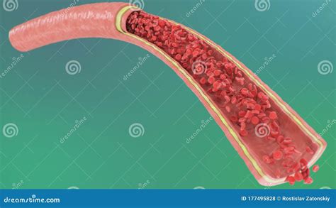 Cross Section Artery View Red Blood Cells Inside An Artery Vein