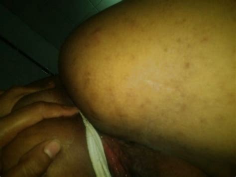 Black Thong Porn Pictures XXX Photos Sex Images PICTOA