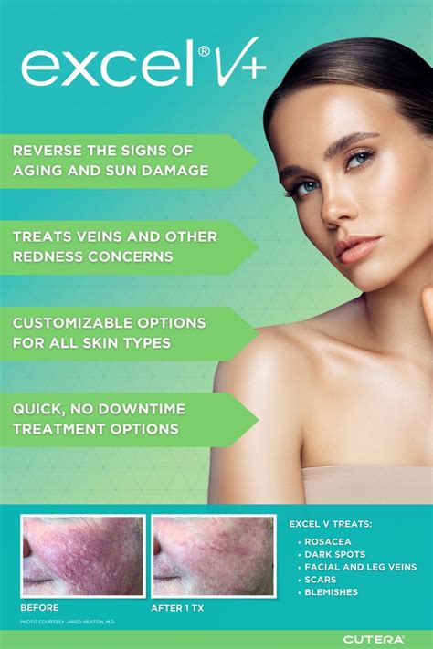 Fresh Laser Skin Studio Updated January Reviews Th