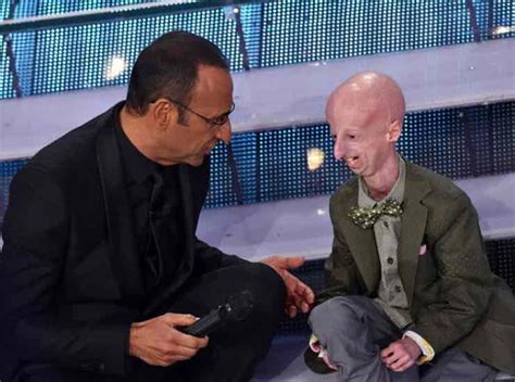 Sammy Basso Un Ambasciatore Di Speranza Contro La Progeria