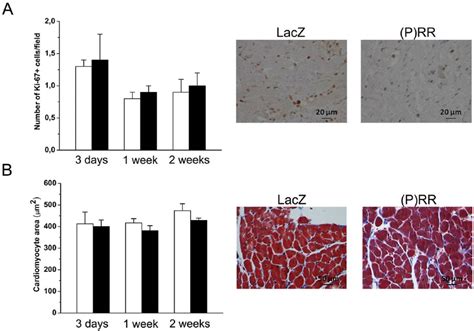 Myocardial Cell Proliferation And Cardiomyocyte Mean Cross Sectional