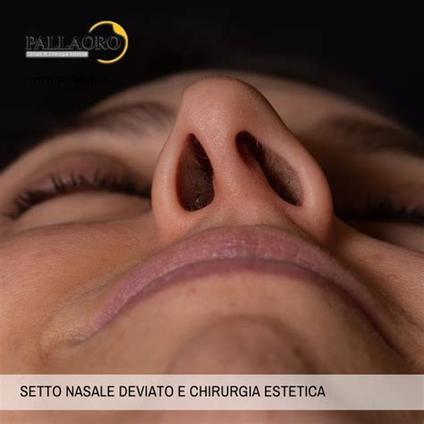 Setto Nasale Deviato Glossario Di Chirurgia Estetica Clinica Pallaoro