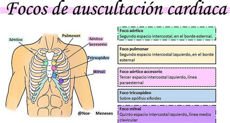 Focos De Auscultación Cardíaca Noe Meneses Udocz